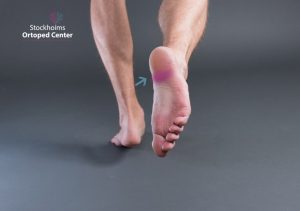 Hälsporre ont i foten